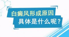 成都在那里有白斑医院？哪些部位易患白癜风